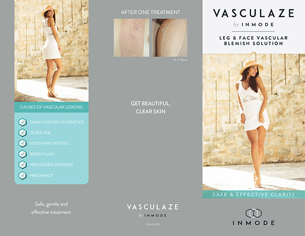 Vasculaze Laser Vein Near Me in Mar Vista Los Angeles, CA