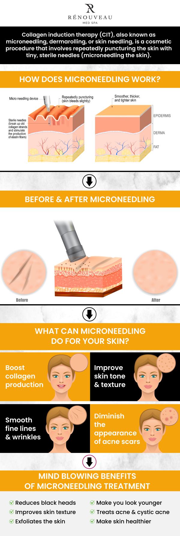 Discover the top benefits of RF Microneedling at Renouveau MedSpa, where Dr. Naini, MD, a leading specialist in aesthetic treatments, delivers exceptional results. This innovative treatment combines radiofrequency and microneedling to boost collagen production, reduce wrinkles, and improve skin texture. With minimal downtime and long-lasting effects, RF Microneedling offers a non-invasive solution for smoother, firmer skin. For more information, contact us now or schedule an appointment online. We are conveniently located at 11600 Washington Place, Culver City, CA 90066. Discover the top benefits of RF Microneedling at Renouveau MedSpa, where Dr. Naini, MD, a leading specialist in aesthetic treatments, delivers exceptional results. This innovative treatment combines radiofrequency and microneedling to boost collagen production, reduce wrinkles, and improve skin texture. With minimal downtime and long-lasting effects, RF Microneedling offers a non-invasive solution for smoother, firmer skin. For more information, contact us now or schedule an appointment online. We are conveniently located at 11600 Washington Place, Culver City, CA 90066.