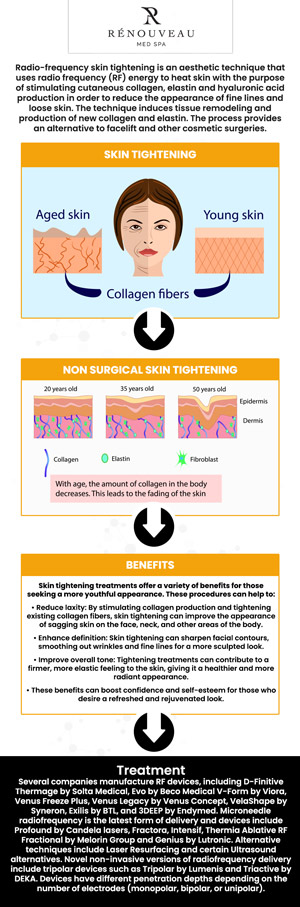 Forma RF skin tightening has many benefits such as increasing skin elasticity, skin tightening, increasing collagen production, improving skin firmness, and it is safe for all skin types. For more information, contact us today or book an appointment online. We are conveniently located at 11600 Washington Place, Culver City, CA 90066. We serve clients from Culver City Los Angeles CA, Downtown LA, Beverly Hills CA, Marina del Rey CA, Venice CA, Playa Vista CA, Mar Vista CA, Playa Del Mar CA, and surrounding areas. Forma RF skin tightening has many benefits such as increasing skin elasticity, skin tightening, increasing collagen production, improving skin firmness, and it is safe for all skin types. For more information, contact us today or book an appointment online. We are conveniently located at 11600 Washington Place, Culver City, CA 90066. We serve clients from Culver City Los Angeles CA, Downtown LA, Beverly Hills CA, Marina del Rey CA, Venice CA, Playa Vista CA, Mar Vista CA, Playa Del Mar CA, and surrounding areas.