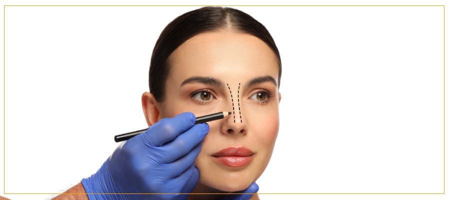 How Can Bunny Lines Treatment Smooth Wrinkles Around the Nose in Culver City, CA? How Can Bunny Lines Treatment Smooth Wrinkles Around the Nose in Culver City, CA?