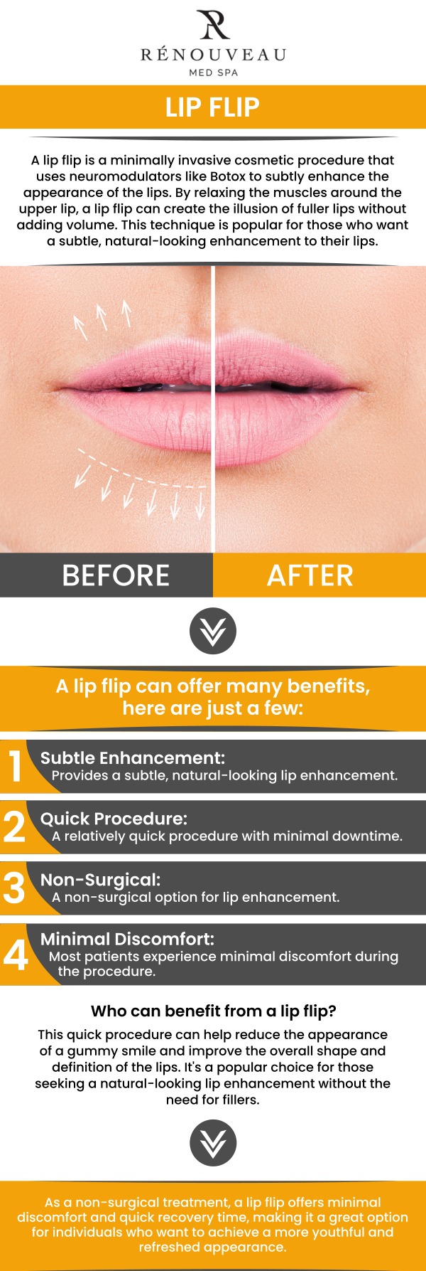 Common questions asked by patients: What is a lip flip, and how does it work? Who is a good candidate for a lip flip? How soon can you see results after a lip flip? How long do lip flip results typically last? How can Renouveau Med Spa personalize a lip flip treatment for clients in Culver City, CA? For more information, contact us today or book an appointment online. We are conveniently located at 11600 Washington Place, Suite 106, Los Angeles, CA 90066. Common questions asked by patients: What is a lip flip, and how does it work? Who is a good candidate for a lip flip? How soon can you see results after a lip flip? How long do lip flip results typically last? How can Renouveau Med Spa personalize a lip flip treatment for clients in Culver City, CA? For more information, contact us today or book an appointment online. We are conveniently located at 11600 Washington Place, Suite 106, Los Angeles, CA 90066.