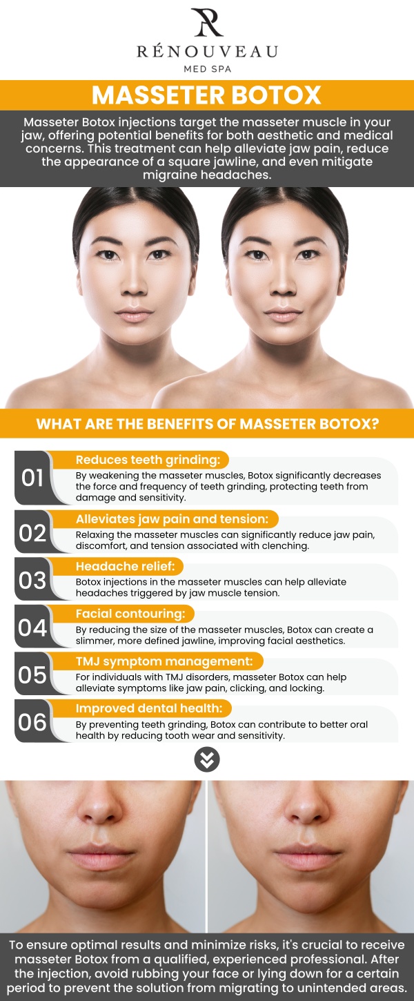 Common questions asked by patients: What is masseter treatment, and how does it work? Who is a good candidate for masseter treatment? Can masseter treatment help create a slimmer-looking jawline? How long do the results of masseter treatment typically last? How can Renouveau Med Spa personalize masseter treatment for clients in Culver City, CA? For more information, contact us today or book an appointment online. We are conveniently located at 11600 Washington Place, Suite 106, Los Angeles, CA 90066. Common questions asked by patients: What is masseter treatment, and how does it work? Who is a good candidate for masseter treatment? Can masseter treatment help create a slimmer-looking jawline? How long do the results of masseter treatment typically last? How can Renouveau Med Spa personalize masseter treatment for clients in Culver City, CA? For more information, contact us today or book an appointment online. We are conveniently located at 11600 Washington Place, Suite 106, Los Angeles, CA 90066.